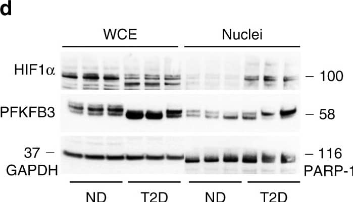 Western Blot HIF-1 alpha Antibody (H1alpha67)