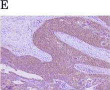 Immunohistochemistry HIF-1 alpha Antibody (H1alpha67)