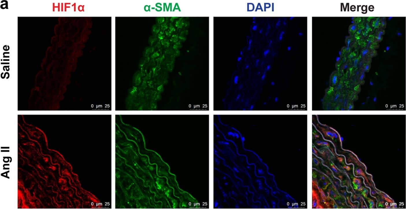 Immunocytochemistry/ Immunofluorescence HIF-1 alpha Antibody (H1alpha67)