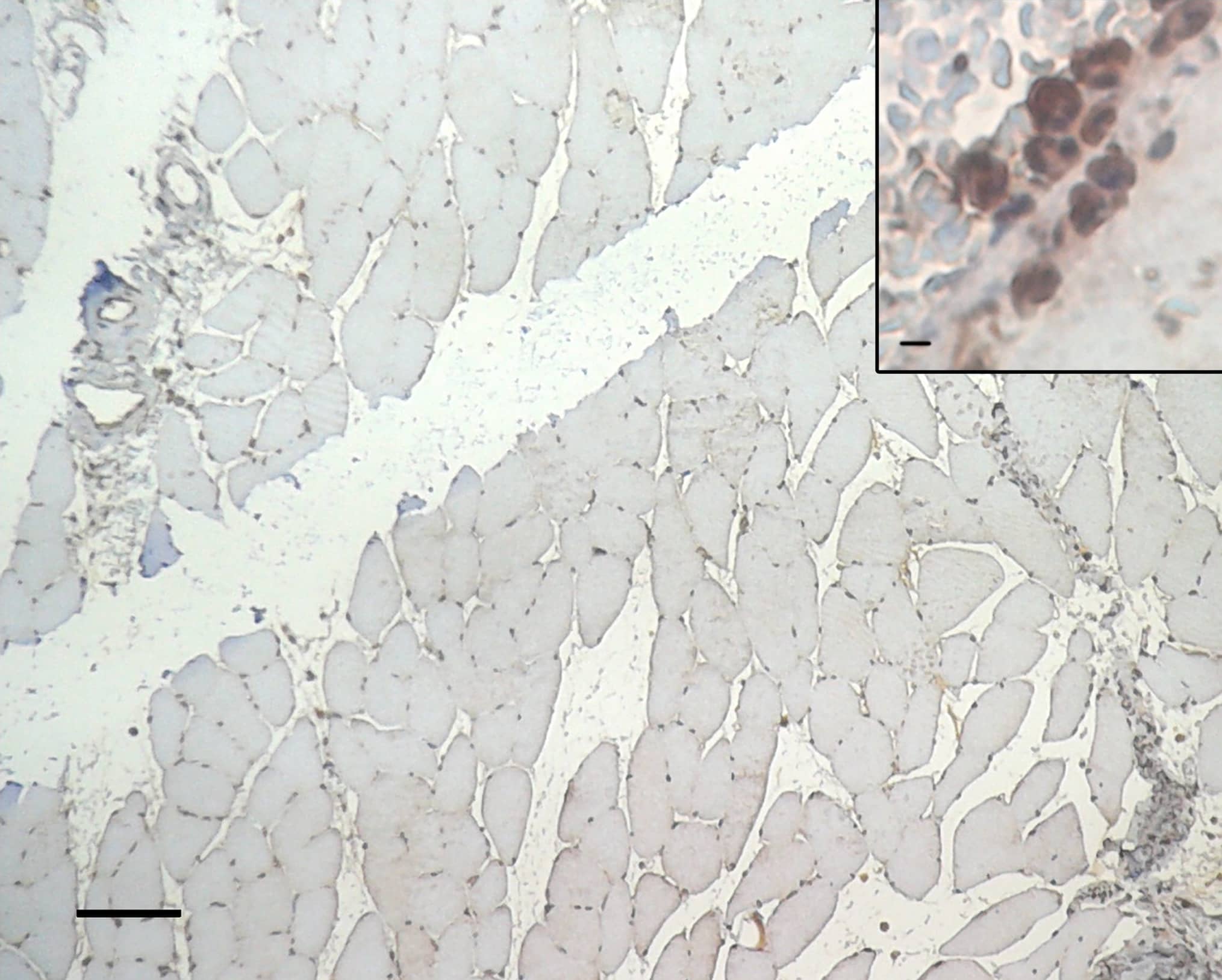 Immunohistochemistry HIF-1 alpha Antibody (H1alpha67)
