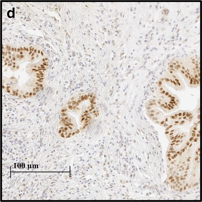 Immunohistochemistry-Paraffin HIF-1 alpha Antibody (H1alpha67)