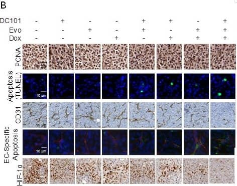 Immunohistochemistry HIF-1 alpha Antibody (H1alpha67)