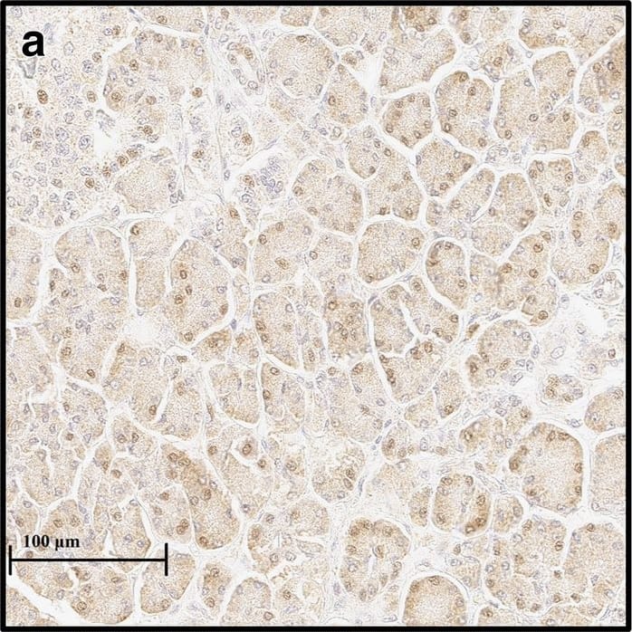 Immunohistochemistry-Paraffin HIF-1 alpha Antibody (H1alpha67)