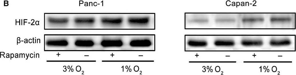 Western Blot HIF-1 alpha Antibody (H1alpha67)