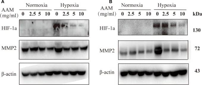 Western Blot HIF-1 alpha Antibody (H1alpha67)