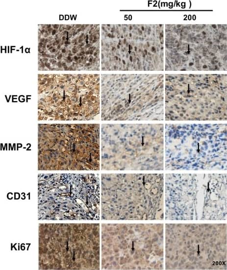Immunohistochemistry-Paraffin HIF-1 alpha Antibody (H1alpha67)