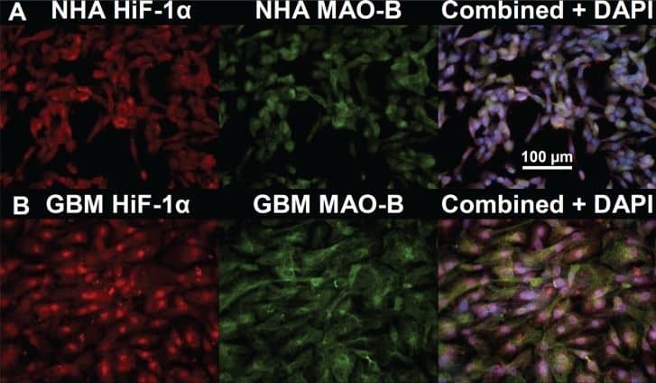 Immunocytochemistry/ Immunofluorescence HIF-1 alpha Antibody (H1alpha67)