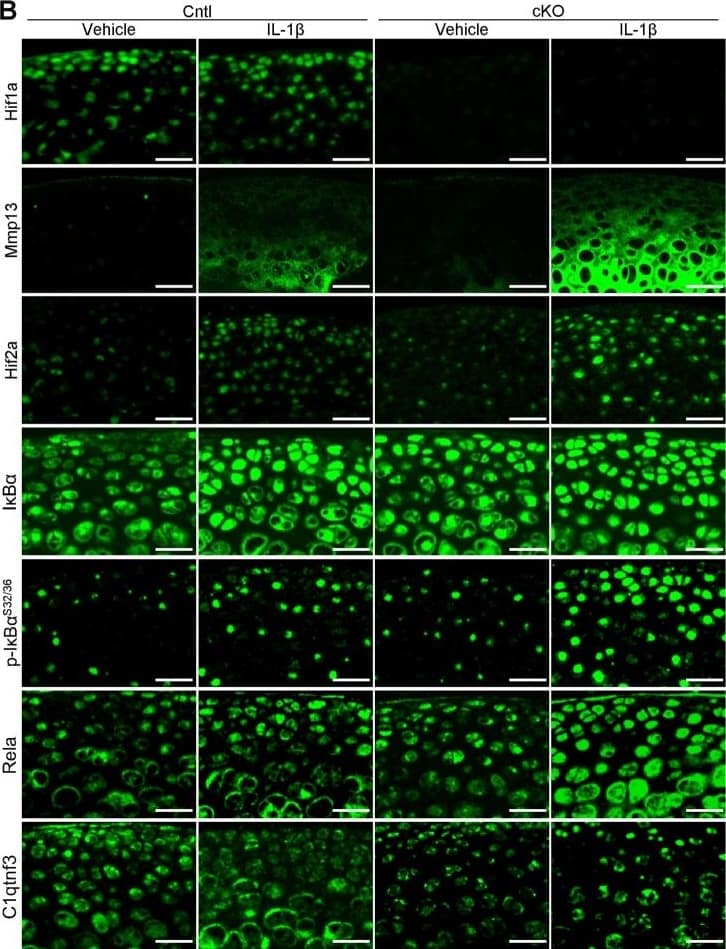 Immunocytochemistry/ Immunofluorescence HIF-1 alpha Antibody (H1alpha67)
