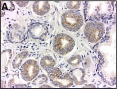 Immunohistochemistry HIF-1 alpha Antibody (H1alpha67)