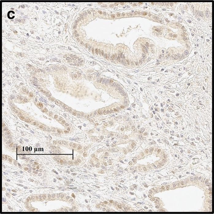 Immunohistochemistry-Paraffin HIF-1 alpha Antibody (H1alpha67)