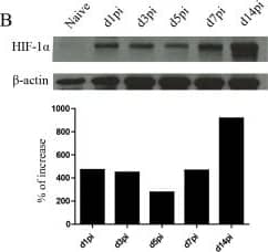Western Blot HIF-1 alpha Antibody (H1alpha67)