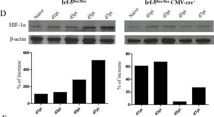 Western Blot HIF-1 alpha Antibody (H1alpha67)