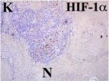 Immunohistochemistry HIF-1 alpha Antibody (H1alpha67)