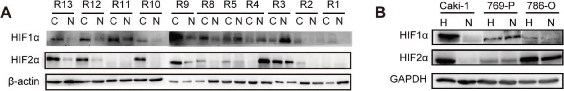 Western Blot HIF-1 alpha Antibody (H1alpha67)