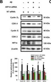 Western Blot HIF-1 alpha Antibody (H1alpha67)