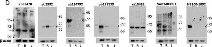 Western Blot: IRF5 Antibody [NB100-1092] - Comparative analysis of IRF5 protein expression between immortalized lymphoid cell lines by immunoblot.(A) qRT-PCR analysis of IRF5 transcript expression in immortalized lymphoid cell lines. Data is presented as relative expression after normalization to  beta -actin using the ∆∆Ct method. (B) Immunoblot analysis of endogenous IRF5 protein expression in immortalized cell lines. IRF5 expression was detected with the previously validated Cell Signaling antibody #3257 that is no longer available.  beta -actin levels & apparent molecular weight standards are shown as loading controls & for size comparison, respectively. (C) Experimental details for the comparative analysis of  alpha -IRF5 antibody specificity by immunoblot analysis. (D) Same as in (B)except lysates (T, THP-1; R, Ramos B cells; J, Jurkat T cells) were run on multiple independent blots for the analysis of antibody specificity; seven different commercially available  alpha -IRF5 antibodies were evaluated. (E) Same as in (D) except antibodies were evaluated by IRF5 knockdown analysis. Ramos B cells were nucleofected with scrambled (Scr) or IRF5 (KD) siRNAs & lysates from same nucleofection run on multiple independent blots for comparative analysis. Arrows indicate detection of an appropriately sized band(s) corresponding to IRF5. Data (except in (C)) are representative of three independent experiments. Image collected & cropped by CiteAb from the following publication (//www.nature.com/articles/srep31002), licensed under a CC-BY license. Not internally tested by Novus Biologicals.
