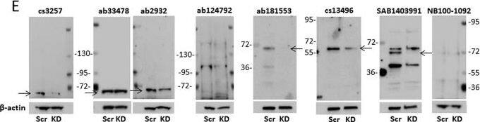 Western Blot: IRF5 Antibody [NB100-1092] - Comparative analysis of IRF5 protein expression between immortalized lymphoid cell lines by immunoblot.(A) qRT-PCR analysis of IRF5 transcript expression in immortalized lymphoid cell lines. Data is presented as relative expression after normalization to  beta -actin using the ∆∆Ct method. (B) Immunoblot analysis of endogenous IRF5 protein expression in immortalized cell lines. IRF5 expression was detected with the previously validated Cell Signaling antibody #3257 that is no longer available.  beta -actin levels & apparent molecular weight standards are shown as loading controls & for size comparison, respectively. (C) Experimental details for the comparative analysis of  alpha -IRF5 antibody specificity by immunoblot analysis. (D) Same as in (B)except lysates (T, THP-1; R, Ramos B cells; J, Jurkat T cells) were run on multiple independent blots for the analysis of antibody specificity; seven different commercially available  alpha -IRF5 antibodies were evaluated. (E) Same as in (D) except antibodies were evaluated by IRF5 knockdown analysis. Ramos B cells were nucleofected with scrambled (Scr) or IRF5 (KD) siRNAs & lysates from same nucleofection run on multiple independent blots for comparative analysis. Arrows indicate detection of an appropriately sized band(s) corresponding to IRF5. Data (except in (C)) are representative of three independent experiments. Image collected & cropped by CiteAb from the following publication (//www.nature.com/articles/srep31002), licensed under a CC-BY license. Not internally tested by Novus Biologicals.