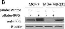 Western Blot: IRF5 Antibody [NB100-1092] - Overexpression of IRF5 in MCF-7 & MDA-MB-231 cells sensitizes them to DNA damage-induced growth inhibition. A. Endogenous IRF expression was analyzed by Western blot in transformed mammary epithelial cell lines. Levels of  beta -actin are shown as loading controls. B. Western blot analysis of stable cell lines generated to overexpress retroviral pBIRF5. C. Cell survival was measured in MCF-7 & MDA-MB-231 pBabe cell lines by colony formation assay before & after treatment. Cells were treated with 0.1 or 1 μM Doxorubicin (Dox) or 2, 5 & 10 Gy  gamma -IR. The number of colonies is plotted on the y-axis as percent of control; 100% represents the number of colonies in empty pBabe control lines. Data are expressed as mean ± SD of three independent experiments performed in duplicate. Statistical significance was determined by comparing the difference between colonies in pBabe versus pBIRF5 cell lines after each treatment; * denotes P < 0.05, ** P < 0.001. Image collected & cropped by CiteAb from the following publication (//breast-cancer-research.biomedcentral.com/articles/10.1186/bcr3053), licensed under a CC-BY license. Not internally tested by Novus Biologicals.