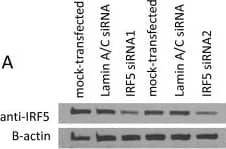 Western Blot: IRF5 Antibody [NB100-1092] - Overexpression of IRF5 in MCF-7 & MDA-MB-231 cells sensitizes them to DNA damage-induced growth inhibition. A. Endogenous IRF expression was analyzed by Western blot in transformed mammary epithelial cell lines. Levels of  beta -actin are shown as loading controls. B. Western blot analysis of stable cell lines generated to overexpress retroviral pBIRF5. C. Cell survival was measured in MCF-7 & MDA-MB-231 pBabe cell lines by colony formation assay before & after treatment. Cells were treated with 0.1 or 1 μM Doxorubicin (Dox) or 2, 5 & 10 Gy  gamma -IR. The number of colonies is plotted on the y-axis as percent of control; 100% represents the number of colonies in empty pBabe control lines. Data are expressed as mean ± SD of three independent experiments performed in duplicate. Statistical significance was determined by comparing the difference between colonies in pBabe versus pBIRF5 cell lines after each treatment; * denotes P  70% reduction of endogenous IRF5 proteins after normalization to  beta -actin levels. B. Cells were exposed to 5 Gy IR or the same dose plus IFN-gamma  (IR/ gamma ) for 24 h. Percent of Annexin V-FITC stained positive cells is shown in the upper & lower right-hand quadrants. Representative histogram plots from three independent experiments performed in duplicate are shown. C. Same as in B, except cells were exposed to 1 μM Dox or Dox & IFN-gamma  for five hours. Percent of Annexin V-FITC stained positive cells compared to control is plotted on y-axis. Data are expressed as mean ± SD of three independent experiments performed in duplicate. Statistical significance was determined by comparing the difference between cells transfected with Lamin A/C siRNAs (12Asicon) & IRF5 siRNAs (12AsiIRF5) after each treatment; ** denotes P < 0.001. D. Cells were treated with the indicated doses of Dox or IR after siRNA transfection. Number of colonies is plotted on y-axis as percent of control. A total of 100% represents the number of colonies in control untreated 12Asicon cells. Data are expressed as mean ± SD of three independent experiments performed in duplicate. Statistical significance was determined by comparing the difference between colonies in 12Asicon versus 12AsiIRF5 cells after each treatment; * denotes P < 0.05. Image collected & cropped by CiteAb from the following publication (//breast-cancer-research.biomedcentral.com/articles/10.1186/bcr3053), licensed under a CC-BY license. Not internally tested by Novus Biologicals.