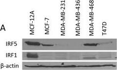 Western Blot: IRF5 Antibody [NB100-1092] - Overexpression of IRF5 in MCF-7 & MDA-MB-231 cells sensitizes them to DNA damage-induced growth inhibition. A. Endogenous IRF expression was analyzed by Western blot in transformed mammary epithelial cell lines. Levels of  beta -actin are shown as loading controls. B. Western blot analysis of stable cell lines generated to overexpress retroviral pBIRF5. C. Cell survival was measured in MCF-7 & MDA-MB-231 pBabe cell lines by colony formation assay before & after treatment. Cells were treated with 0.1 or 1 μM Doxorubicin (Dox) or 2, 5 & 10 Gy  gamma -IR. The number of colonies is plotted on the y-axis as percent of control; 100% represents the number of colonies in empty pBabe control lines. Data are expressed as mean ± SD of three independent experiments performed in duplicate. Statistical significance was determined by comparing the difference between colonies in pBabe versus pBIRF5 cell lines after each treatment; * denotes P < 0.05, ** P < 0.001. Image collected & cropped by CiteAb from the following publication (//breast-cancer-research.biomedcentral.com/articles/10.1186/bcr3053), licensed under a CC-BY license. Not internally tested by Novus Biologicals.
