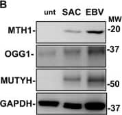 The antioxidant pathways are activated during EBV infection & are required for growth transformation. Freshly isolated B-lymphocytes infected with the transforming B95-8 strain of EBV were cultured for up to 2 weeks in the presence or absence of MTH1 inhibitors. Protein expression was monitored by western blots, cell proliferation & activation of the DDR were assessed by 3H-Thy incorporation & staining for  gamma H2AX, respectively. a representative western blots illustrating the parallel increase of MTH1 & EBNA1 expression following EBV infection & mean ± SE of the intensity of the MTH1 specific band in five independent experiments. b Representative western blots illustrating the expression of MTH1, MUTYH & OGG1 in ex vivo untreated B-cell & freshly EBV infected & SAC induced B blasts cultured for comparable times & showing similar levels of cell proliferation. c Quantification of the specific bands. Relative expression is the ration between the intensity in the treated cells versus freshly harvested cells. The mean ± SE of three to four independent experiments is shown. d Inhibition of MTH1 prevents the establishment of EBV transformed lymphoblastoid cell lines. 3H-Thy incorporation was measured after culture of freshly EBV infected B-lymphocytes in the presence of the indicated amounts of MTH1 inhibitors. Depending on the condition of the cultures harvesting was done after ten to fifteen days. e Inhibition of MTH1 strongly enhances the induction of DNA damage in freshly EBV infected cells. DNA damage was detected by  gamma H2AX staining. f Mean ± SE of the %  gamma H2AX positive cells in three independent experiments. *P < 0.05; **P < 0.01 Image collected & cropped by CiteAb from the following publication (//pubmed.ncbi.nlm.nih.gov/31511648), licensed under a CC-BY license. Not internally tested by Novus Biologicals.
