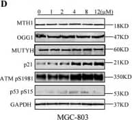 Western Blot: MTH1 Antibody - BSA Free [NB100-109] - Compound MI-743 causes intracellular 8-oxo-dG accumulation & DNA damage.a MGC-803, HGC-27 & GES-1 cells were treated with DMSO or 5 µM MI-743 for 48 h. Intracellular 8-oxo-dG was stained with Cy3-conjugated avidin. DNA was counterstained with 4,6-diamidino-2-phenylindole (DAPI). Images were acquired at ×100 magnification by a Nikon Eclipse TE 2000-S fluorescence microscope. At least three independent experiments were performed for each group. b MGC-803, HGC-27 & GES-1 cells were treated with DMSO or 10 µM MI-743 for 48 h & run in alkaline comet assay. Pictures were originally captured at ×40 magnification. H2O2 was used as positive control. c Tail moment was calculated by CometScore software. Three individual experiments were performed for each group. d–f Western blot analysis of the protein levels of MTH1, MUTYH, OGG1, p21, ATMpS1981 & p53pS15 in MGC-803, HGC-27 & GES-1 cells, treated with increasing concentrations of MI-743 (0, 1, 2, 4, 8 & 12 µM). g, h Densitometry shows relative protein expression normalized for GAPDH. Data are representative of three independent experiments. i–k Western Blot analysis of the protein levels of MTH1, MUTYH, OGG1, p21, ATMpS1981 & p53pS15 of protein lysates, isolated from MGC-803, HGC-27 & GES-1 cells, which were treated with 12 µM MI-743 for 0, 12, 24, 36 & 48 h. l, m Densitometry shows relative protein expression normalized for GAPDH. Data are presented as means ± SD. Three individual experiments were performed for each group. *P < 0.05, **P < 0.01, ***P < 0.001 as compared with the controls Image collected & cropped by CiteAb from the following publication (//pubmed.ncbi.nlm.nih.gov/31164636), licensed under a CC-BY license. Not internally tested by Novus Biologicals.