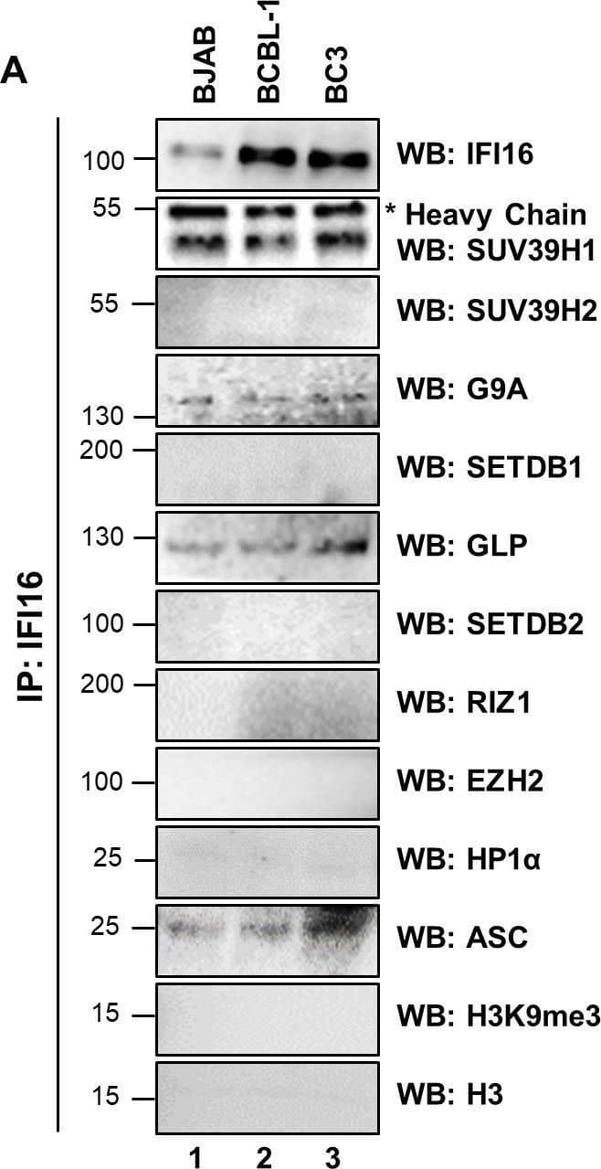 Demonstration of IFI16’s interaction with specific H3K9 MTases in KSHV latently infected PEL (BCBL-1 and BC-3) cells and in uninfected control BJAB cells.(A) Nuclear fractions were isolated from latently infected cells and uninfected BJAB cells and treated with Benzonase. IPs were performed using anti-IFI16 mAb and LANA mAb and WBs were performed. (B) To confirm IFI16’s and LANA’s interaction with H3K9 MTases, IPs were done with Abs against the H3K9 MTases and blotted for the corresponding MTase, IFI16, LANA and HP1 alpha  (heterochromatin protein 1 alpha ). Image collected and cropped by CiteAb from the following open publication (//pubmed.ncbi.nlm.nih.gov/31682228), licensed under a CC-BY license. Not internally tested by Novus Biologicals.