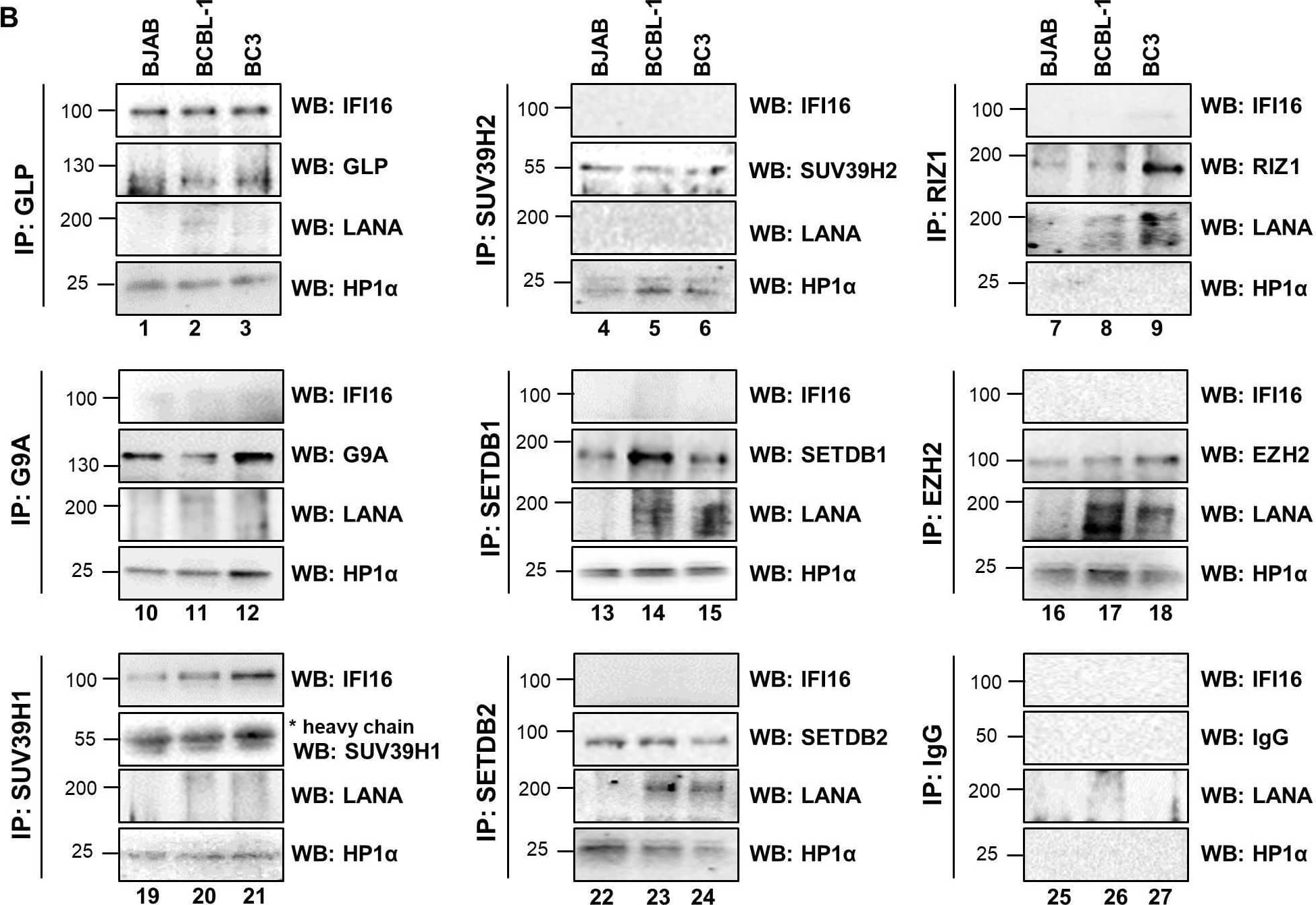 Demonstration of IFI16’s interaction with specific H3K9 MTases in KSHV latently infected PEL (BCBL-1 and BC-3) cells and in uninfected control BJAB cells.(A) Nuclear fractions were isolated from latently infected cells and uninfected BJAB cells and treated with Benzonase. IPs were performed using anti-IFI16 mAb and LANA mAb and WBs were performed. (B) To confirm IFI16’s and LANA’s interaction with H3K9 MTases, IPs were done with Abs against the H3K9 MTases and blotted for the corresponding MTase, IFI16, LANA and HP1 alpha  (heterochromatin protein 1 alpha ). Image collected and cropped by CiteAb from the following open publication (//pubmed.ncbi.nlm.nih.gov/31682228), licensed under a CC-BY license. Not internally tested by Novus Biologicals.