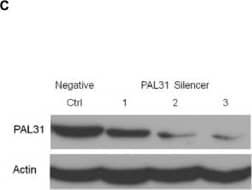 Western Blot: ANP32B Antibody [NB100-1199] - Effect of overexpression or knockdown of PAL31 in C6 on H2O2-induced toxicity. (A) Representative micrographs showing C6 overexpressing GFP or GFP-tagged PAL31 after being treated with H2O2 (0 ~ 1 mM) for 4 hours. (B) MTT assay in GFP- or GFP-PAL31-overexpressed C6 after H2O2 treatment showing significant difference (cytoprotective effect of PAL31) at 0.5 mM & 1 mM H2O2 treatment between C6/GFP & C6/PAL31 groups. The data in each dosage were analyzed by two-way ANOVA & Bonferroni post hoc test. *P < 0.05, GFP (+H2O2) compared to PAL31 (+H2O2), n = 4, at 0.5 mM & 1 mM. (C) Western blot analysis of pal31 siRNA-treated C6 showing knockdown of PAL31 expression by PAL31 silencer using 41.5 (lane1), 83 (lane2), & 166 (lane 3) picomole of pal31 siRNA or 332 picomole negative control. Actin works as a loading control. (D) MTT assay in Negative- or PAL31 silencer transfected C6 after H2O2 treatment showing significant difference at 1 mM H2O2 treatment between C6/Negative & C6/PAL31 siRNA groups. *P < 0.05, Negative (+H2O2) compared to PAL31 siRNA (+H2O2), n = 4. Magnification 100X (A). Image collected & cropped by CiteAb from the following publication (//pubmed.ncbi.nlm.nih.gov/25034417), licensed under a CC-BY license. Not internally tested by Novus Biologicals.