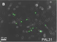 Immunocytochemistry/ Immunofluorescence: ANP32B Antibody [NB100-1199] - Overexpression of PAL31 in C6 did not affect the cell proliferative activity. (A) GFP/bright field-superimposed micrograph in GFP overexpressing cells showing > 50% transfective efficiency (B) GFP-PAL31/bright field-micrograph in PAL31 overexpressing C6 showing correct nuclear localization of GFP-tagged PAL31 & transfection effeciency. (C) Western blot analysis showing the expression of GFP (~27 kDa), GFP-tagged PAL31 (~58 kDa), PCNA (~34 kDa), endogenous PAL31 (~31 kDa) & Actin (~43 kDa) in GFP- or PAL31-C6 cultures. The level of PCNA, a protein expressing in nuclear during DNA synthesis, in cells did not alter after overexpression of GFP or GFP-tagged PAL31. Actin works as a loading control. (D) MTT assay in the transfected cells at 4 different time intervals (from Ctrl to 72 hours). Ctrl represents the cells after subculture & overnight incubation. The data in each time points were analyzed by two-way ANOVA & Bonferroni post hoc test. No significance, compared GFP & GFP tagged PAL31 groups. n = 3. Magnification 100X (A-B). Image collected & cropped by CiteAb from the following publication (//pubmed.ncbi.nlm.nih.gov/25034417), licensed under a CC-BY license. Not internally tested by Novus Biologicals.