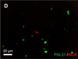 Immunocytochemistry/ Immunofluorescence: ANP32B Antibody [NB100-1199] - Overexpression of PAL31 in mixed glial culture effectively reduced LPS/IFN gamma  stimulation after co-culture with spinal cord neuron-glial cultures. (A) ED-1- immunoreactive microglia/macrophage in confluent mixed glial cultures (B) S100- immunoreactive astroglia in confluent mixed glial cultures (C) LPS/IFN gamma -stimulated neuron-glial co-cultures (Glia/GFP + neuron) showing expression of both iNOS & GFP (D) LPS/IFN gamma -stimulated neuron-glial co-cultures (Glia/PAL31+ neuron) showing expression of both iNOS & PAL31. (E) Quantitative analysis of released nitric oxide, as a form of nitrite, in LPS/IFN gamma -stimulated or non-stimulated neuron-glial co-culture. Mixed glial cultures were transfected with pGFP or pPAL31 before seeding spinal cord neurons. Co-cultures were then treated with LPS/IFN gamma  for 2 days. Medium were saved for nitrite level determination, while cells were processed for immunostaining with iNOS. *P < 0.05, n = 4. PAL31 overexpressing co-cultures (+LPS/IFN gamma ) compared to GFP overexpressing co-cultures (+LPS/IFN gamma ). Magnification 200X (A-D). Image collected & cropped by CiteAb from the following publication (//pubmed.ncbi.nlm.nih.gov/25034417), licensed under a CC-BY license. Not internally tested by Novus Biologicals.