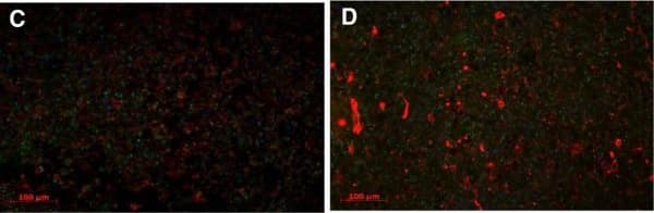 Immunocytochemistry/ Immunofluorescence: ANP32B Antibody [NB100-1199] - Upregulated PAL31 expression was observed not only in microglia/ macrophage but also in glial cells near the injury site. (A) Normal thoracic spinal cord section showing few ED-1 positive cells (red). (B) Normal thoracic spinal cord section showing GFAP positive cells (red). (C) Representative micrograph showing colocalization of upregulated PAL31 (green) with microglia/macrophage (ED1 positive cells) (D) Representative micrograph showing colocalization of upregulated PAL31 with astroglia (GFAP positive cells). (E) High power image showing the colocalization of upregulated PAL31 with ED1 positive macrophage/microglia (arrowhead) (F) High power image demonstrating the colocalization of upregulated PAL31 with GFAP positive astroglia (arrow). Magnification: 200X (A-D) & 1000X (E&F). Image collected & cropped by CiteAb from the following publication (//pubmed.ncbi.nlm.nih.gov/25034417), licensed under a CC-BY license. Not internally tested by Novus Biologicals.