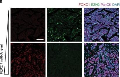 Immunocytochemistry/ Immunofluorescence: FoxC1 Antibody [NB100-1268] - Breast Cancer subtype specificity of the EZH2/FOXC1 metastatic axis. a Representative images of formalin fixed paraffin-embedded tissue samples from human Luminal B tumours stained for FOXC1 & EZH2. Scale bar is 100 μm. b Significant negative correlation between FOXC1 transcript levels & EZH2 protein levels (Total intensity) quantified by immunofluorescence in human Luminal B patient samples (r = −0.52, p = 0.02). Eight different fields taken with a ×20 objective were quantified per sample. c Kaplan–Meier survival curve of relapse-free survival (RFS) of 1142 luminal B tumours with high or low FOXC1 (log rank p = 0.001). d Correlation between FOXC1 mRNA levels & the FOXC1 Signature in a cohort of 385 Luminal B patients from publicly available TCGA Breast Cancer data set. e Kaplan–Meier analysis of relapse-free survival of 1142 Luminal B tumours with high or low FOXC1 gene signature expression (log rank p = 0.0044). RFS relapse-free survival Image collected & cropped by CiteAb from the following publication (//pubmed.ncbi.nlm.nih.gov/29959321), licensed under a CC-BY license. Not internally tested by Novus Biologicals.