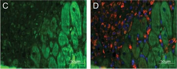 (P)RR is located into the cardiac myocytes in the rat heart.Immunofluorescence staining of LV anterior wall at day 3 after gene transfer showing (P)RR predominantly in cardiomyocytes. A, DAPI (blue), B, prolyl 4-hydroxylase  beta  staining for fibroblasts (red), C, (P)RR (green) and D, Merge. Representative image is shown.
