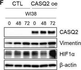 CASQ2 affects the TME and invasiveness through HIF1 alpha . (A) Kyoto Encyclopedia of Genes and Genomes (KEGG) pathway analysis using the mouse genome (Differentially expressed genes, DEGs; n = 530). (B) The heatmap for average of expression (FPKM) value of most significant differentially expressed genes of angiogenesis and the HIF1 alpha  signaling pathway. (C) The mRNA level of Hif1a, Pgf, Flt1, Kdr, Flt4, and Nos3 in Hs578T‐CTL and CASQ2 o/e tumors (means +/- SEM, n = 3; ***P < 0.001 by the multiple t‐test). (D, E) Expression level of  alpha ‐SMA, FSP, and HIF1 alpha  in WI‐38 cells after indirect coculture with Hs578T‐CTL or Hs578T‐CASQ2 o/e cells (means +/- SEM, n = 3; *P < 0.05 by the multiple t‐test). (F, G) Expression level of CASQ2 and vimentin in Hs578T‐CTL or Hs578T‐CASQ2 o/e cells indirectly cocultured with WI‐38 (means +/- SEM, n = 3; *P < 0.05 by the multiple t‐test). Image collected and cropped by CiteAb from the following open publication (//pubmed.ncbi.nlm.nih.gov/34743414), licensed under a CC-BY license. Not internally tested by Novus Biologicals.