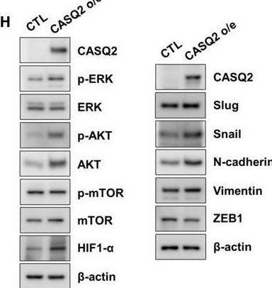 CASQ2 induces phenotypic changes in breast cancer cells. (A) Relationship between the proliferation rate and overexpression of CASQ2 in breast cancer cell lines (mean +/- SEM, n = 3; *P < 0.05, **P < 0.01, and ***P < 0.001 using the multiple t‐test). (B) Migration and invasion rates of Hs578T cells (mean +/- SEM, n = 3; **P < 0.01 using two‐tailed Student’s t‐test). Scale bar = 50 μm. (C) Three‐dimensional culture of Hs578T cells (mean +/- SEM, n = 3; **P < 0.01 using two‐tailed Student’s t‐test). Scale bar = 100 μm. (D) Tumorsphere culture of Hs578T cells (mean +/- SEM, n = 3; **P < 0.01 using two‐tailed Student’s t‐test). Scale bar = 100 μm. (E) Expression of CD44, CD24, and ALDH1 cancer stem cell markers in adherent and tumorsphere cultures of Hs578T cells. (F) Measurement of intracellular Ca2+ in Hs578T cells using a calcium crimson reagent. Cells were loaded with the calcium indicator calcium crimson (5 μm) for 30 min, and then, BAPTA‐AM (10 μm) was added. After washing, the cells were stimulated by treatment with 5 μm caffeine to measure the intracellular calcium concentration at 360 s (mean +/- SEM, n = 3; *P < 0.05 and **P < 0.01 after ANOVA with Tukey’s post hoc test). (G) Effect of lacidipine on the expression of cancer stem cell markers in tumorspheres of breast cancer cells. The figure shows one of three independent experiments. Statistical test result is shown in Fig. S6. (H) Epithelial–mesenchymal transition (EMT)‐related protein expression in breast cancer cells. All results are representatives of three independent experiments. Image collected and cropped by CiteAb from the following open publication (//pubmed.ncbi.nlm.nih.gov/34743414), licensed under a CC-BY license. Not internally tested by Novus Biologicals.