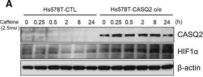 CASQ2 affects the tumor invasiveness through HIF1 alpha . (A, B) Expression level of HIF1 alpha  in caffeine‐treated Hs578T cells with or without overexpression of CASQ2 (means +/- SEM, n = 3; *P < 0.05, **P < 0.01 by the Mann–Whitney U‐test). (C) Confocal microscopy images showing F‐actin in Hs578T cells overexpressing CASQ2 under hypoxic conditions (**P < 0.01 by the Mann–Whitney U‐test). Scale bar = 10 μm. (D) Proliferation rate of control (CTL) and CASQ2‐overexpressing (CASQ2 o/e) breast cancer cells under normoxic and hypoxic conditions (mean +/- SEM, n = 3; *P < 0.05, **P < 0.01, ***P < 0.001, and ****P < 0.0001 by ANOVA with Tukey’s post hoc test). (E, F) Hematoxylin and eosin staining of lung tissue sections from Hs578T‐CTL‐ or CASQ2‐derived tumors (mean +/- SEM, n = 5; *P < 0.05 and **P < 0.01 by two‐tailed Student’s t‐test). Scale bar = 100 μm. Image collected and cropped by CiteAb from the following open publication (//pubmed.ncbi.nlm.nih.gov/34743414), licensed under a CC-BY license. Not internally tested by Novus Biologicals.