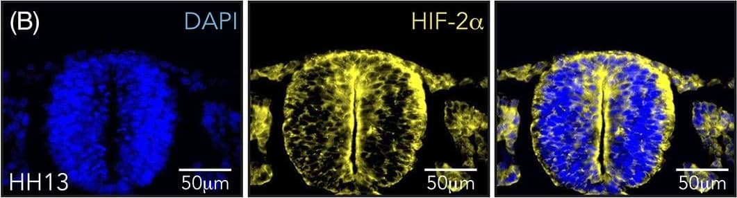 Hypoxia inducible factor (HIF)‐2 alpha  is expressed in trunk neural crest cells. A,C, Immunostaining of HIF‐2 alpha  in sections from trunk axial level of wild‐type chick embryos at HH11, A, HH13, B, and HH18, C. Arrow denotes ventrally migrating HIF‐2 alpha  positive cells. D, Co‐immunostaining of HIF‐2 alpha  and HNK1 (marker of migrating neural crest) in sections from trunk axial level of wild‐type HH18 chick embryos. Arrows denote migrating cells double positive for the two proteins. E, Sections of HH13 wild‐type embryo immunostained with DAPI for visualization of nuclei and secondary antibody only (donkey anti‐rabbit Alexa Fluor‐546). F, Western blot analysis for detection of HIF‐2 alpha  protein at 21% and 1% O2 following siRNA mediated knockdown of HIF‐1 alpha  or HIF‐2 alpha . DIP treated cells were used as a positive control and SDHA as loading control. Lanes between 21% and 1% siCTRL were removed from this figure, indicated by the black line. G, Immunohistochemical staining for HIF‐2 alpha  in sections of SK‐N‐BE(2)c neuroblastoma cells cultured at 21% or 1% O2. H, Schematic of where oxygen measurements were performed. I, Oxygen saturation in the trunk of chick embryos during development measured ex ovo using microsensor technique. Error bars represent SEM, n ≥ 3 biologically independent replicates for each time point Image collected and cropped by CiteAb from the following open publication (//pubmed.ncbi.nlm.nih.gov/32940375), licensed under a CC-BY license. Not internally tested by Novus Biologicals.