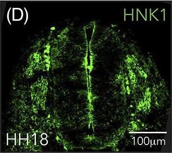 Hypoxia inducible factor (HIF)‐2 alpha  is expressed in trunk neural crest cells. A,C, Immunostaining of HIF‐2 alpha  in sections from trunk axial level of wild‐type chick embryos at HH11, A, HH13, B, and HH18, C. Arrow denotes ventrally migrating HIF‐2 alpha  positive cells. D, Co‐immunostaining of HIF‐2 alpha  and HNK1 (marker of migrating neural crest) in sections from trunk axial level of wild‐type HH18 chick embryos. Arrows denote migrating cells double positive for the two proteins. E, Sections of HH13 wild‐type embryo immunostained with DAPI for visualization of nuclei and secondary antibody only (donkey anti‐rabbit Alexa Fluor‐546). F, Western blot analysis for detection of HIF‐2 alpha  protein at 21% and 1% O2 following siRNA mediated knockdown of HIF‐1 alpha  or HIF‐2 alpha . DIP treated cells were used as a positive control and SDHA as loading control. Lanes between 21% and 1% siCTRL were removed from this figure, indicated by the black line. G, Immunohistochemical staining for HIF‐2 alpha  in sections of SK‐N‐BE(2)c neuroblastoma cells cultured at 21% or 1% O2. H, Schematic of where oxygen measurements were performed. I, Oxygen saturation in the trunk of chick embryos during development measured ex ovo using microsensor technique. Error bars represent SEM, n ≥ 3 biologically independent replicates for each time point Image collected and cropped by CiteAb from the following open publication (//pubmed.ncbi.nlm.nih.gov/32940375), licensed under a CC-BY license. Not internally tested by Novus Biologicals.