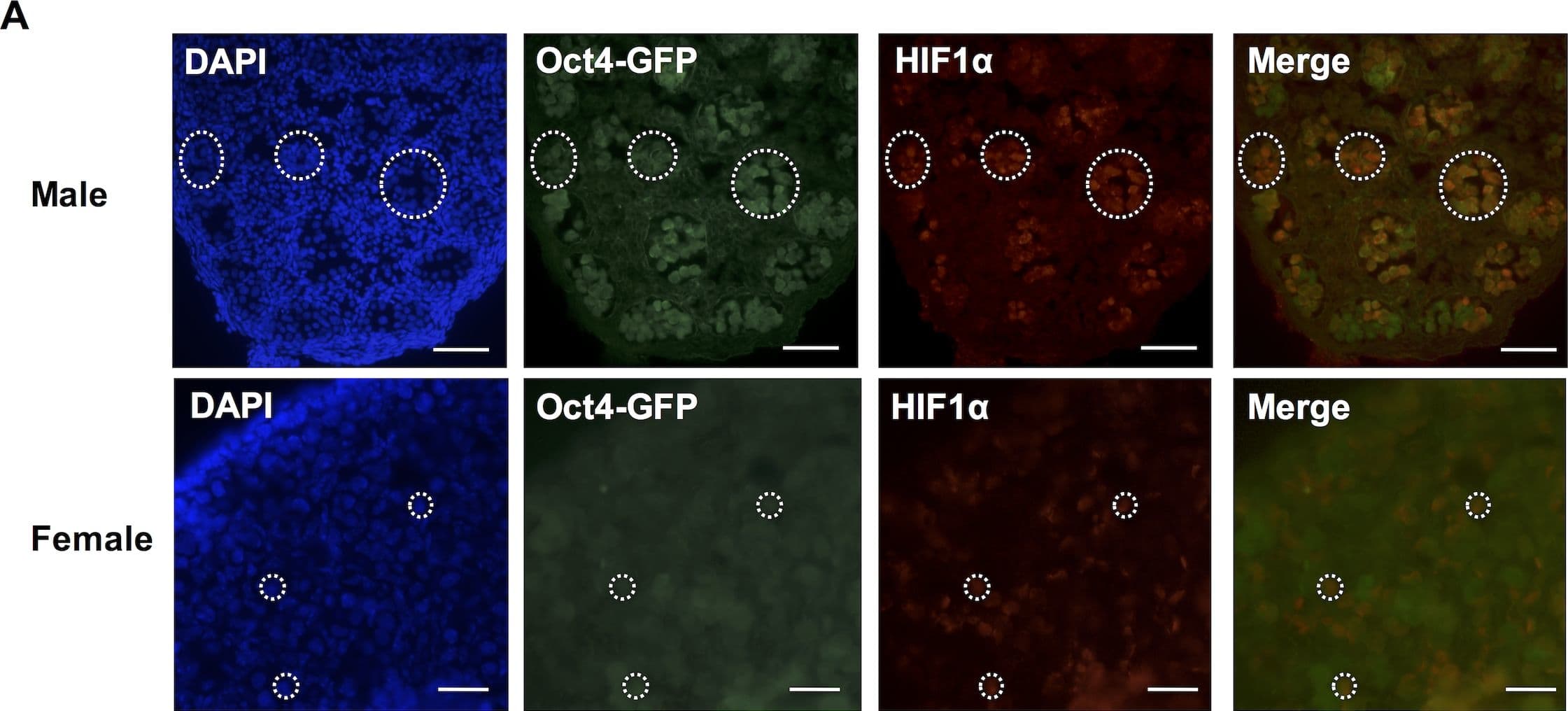 Immunocytochemistry/ Immunofluorescence: HIF-1 alpha Antibody - BSA Free [NB100-134] - Hif1 alpha  expression in 15.5dpc germ cells.(A) Sections of male (top) & female (bottom) gonads from 15.5 dpc Oct4-GFP embryos showing Oct4-GFP & Hif1 alpha  expressions in germ cells. Scale bars: 50μm (male) & 20μm (female). (B) FACS-sorted male (top) & female (bottom) 15.5dpc germ cells showing Oct4-GFP & Hif1 alpha  expressions. Scale bars: 100μm (male) & 50μm (female). Image collected & cropped by CiteAb from the following publication (//pubmed.ncbi.nlm.nih.gov/27148974), licensed under a CC-BY license. Not internally tested by Novus Biologicals.