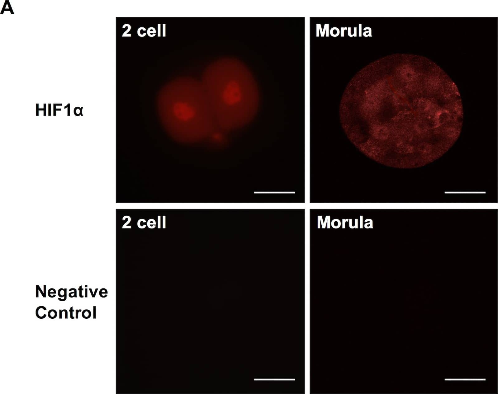 Immunocytochemistry/ Immunofluorescence: HIF-1 alpha Antibody - BSA Free [NB100-134] - Hif1 alpha  expression in preimplantation embryos.(A) Hif1 alpha  staining in two-cell stage embryo & morula (top) & negative control images without primary antibody (bottom). (B) Co-staining of OCT4 & Hif1 alpha  in inner cell mass of blastocyst (top) & negative control images without primary antibodies (bottom). Scale bar: 30μm. Image collected & cropped by CiteAb from the following publication (//pubmed.ncbi.nlm.nih.gov/27148974), licensed under a CC-BY license. Not internally tested by Novus Biologicals.