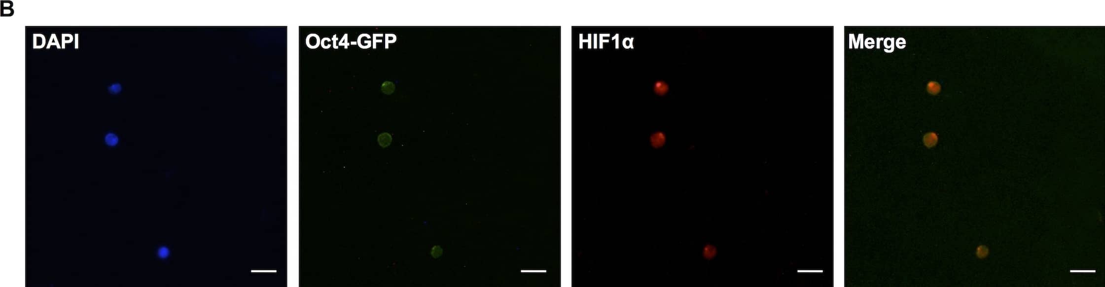 Immunocytochemistry/ Immunofluorescence: HIF-1 alpha Antibody - BSA Free [NB100-134] - Hif1 alpha  expression in 9.5dpc primordial germ cells.(A) Whole-mount staining of Hif1 alpha  & GFP in Oct4-GFP embryo (lateral view). Scale bar: 100μm. (B) Hif1 alpha  & GFP staining of FACS-sorted PGCs. Scale bar: 20μm. Image collected & cropped by CiteAb from the following publication (//pubmed.ncbi.nlm.nih.gov/27148974), licensed under a CC-BY license. Not internally tested by Novus Biologicals.