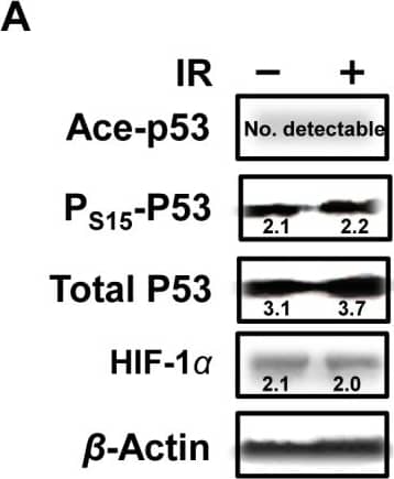Western Blot: HIF-1 alpha Antibody - BSA Free [NB100-134] - P53 was increased response to IR in the fetal brain.Even though no significant change in protein level, total p53 & phosphorylation of P53 at ser15 were increased compared with HIF-1 alpha  in fetal brains response to IR. Numbers in the pictures show the average of three independent experiments (n = 3 from 3 individual pregnant mice). Image collected & cropped by CiteAb from the following publication (//dx.plos.org/10.1371/journal.pone.0110577), licensed under a CC-BY license. Not internally tested by Novus Biologicals.
