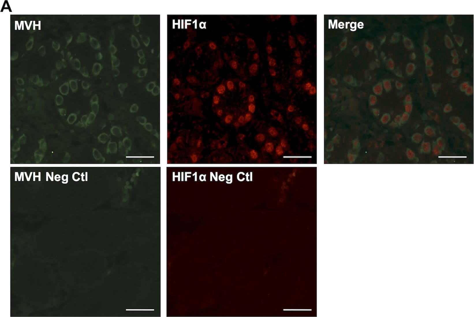 Immunocytochemistry/ Immunofluorescence: HIF-1 alpha Antibody - BSA Free [NB100-134] - Hif1 alpha  expression in neonatal & adult testis.(A) Section of testis from 5-day old (P5) male new born pups showing Hif1 alpha  expression in MVH+ gonocytes within the seminiferous tubules (top) & negative control images without primary antibodies (bottom). Scale bar: 50μm. (B) Western blot analysis of Hif1 alpha  expression in P5 testes (left) compared to extract of the adult brain sub-ventricular zone (SVZ) (right). Loading control ( beta -Actin) is shown below. (C) Section of adult (3 month old) testis showing Hif1 alpha  expression in spermatogonia. Scale bar: 30μm. (D) Western blot analysis of whole adult testis. HEK293 cells treated with DFX were used as a positive control & intestinal tissue was used as a negative control. Loading control ( beta -Actin) is shown below. Image collected & cropped by CiteAb from the following publication (//pubmed.ncbi.nlm.nih.gov/27148974), licensed under a CC-BY license. Not internally tested by Novus Biologicals.