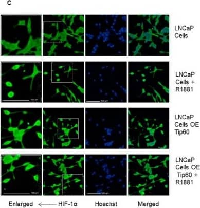 Immunocytochemistry/ Immunofluorescence: HIF-1 alpha Antibody - BSA Free [NB100-134] - HIF-1 alpha  levels are increased by androgen stimulus & Tip60 overexpression in LNCaP cells. (A) Nuclear & (B) cytosolic HIF-1 alpha  levels & (C) images in LNCaP cells & in LNCaP cells overexpressing Tip60, in the absence or presence of androgen (10 nM R1881, 72 h). HIF-1 alpha  levels were detected by immunofluorescence using confocal imaging system. Images were acquired with 20x objective. Staining intensity levels in the nucleus & cytosolic region were obtained using Harmony software. Nucleus & cytosol were identified through Hoechst & CellMask staining, respectively. Scale is shown as 100 μm. White dotted frames indicate the section of the image that was enlarged. Values are expressed as mean ± SEM, from three independent culture preparations, each treatment performed in quadruplicate. Two-way ANOVA, Bonferroni post-test & p values comparisons are specified in the figures (* p < 0.05). HIF-1 alpha , hypoxia-inducible factor-1 alpha ; OE, overexpressing; R1881, synthetic androgen. Image collected & cropped by CiteAb from the following publication (//pubmed.ncbi.nlm.nih.gov/31671779), licensed under a CC-BY license. Not internally tested by Novus Biologicals.