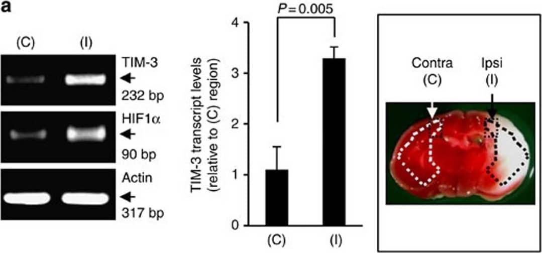 Western Blot: HIF-1 alpha Antibody - BSA Free [NB100-134] - TIM-3 is highly expressed in hypoxic brain regions of a H/I mouse model.(a) TIM-3 transcript levels were examined in brain tissues from the contralateral cortex (C, boxed region) & ischaemic ipsilateral cortex (I, boxed region) of mouse model 24 h after H/I. The RT–PCR products were quantified with Image J & normalized with respect to the expression of actin. The HIF-1 alpha  transcript level represents a positive control for hypoxia. The right panel shows representative TTC staining of three brain sections from the H/I mice. (b) Representative western blot analyses of the TIM-3 & HIF-1 alpha  proteins (n=3). Relative levels of TIM-3 are shown as the mean±s.d. from three independent experiments. (c) Contralateral & ipsilateral cortical regions of coronal sections from the H/I mice were subjected to immunohistochemistry using an anti-TIM-3 antibody, & the number of TIM-3-expressing cells per mm2 was counted. (d) Immunohistochemistry was performed on brain sections from the H/I mice using anti-TIM-3 & hypoxyprobe-1 (red, to detect hypoxic regions). Scale bars, 50 μm ( × 20); 50 μm ( × 40). (e,f) Brain cells were isolated from the ipsilateral & contralateral hemispheres of three mice per group, processed for simultaneous detection of TIM-3 plus Iba-1 (e) or GFAP (f), & analysed by FACS. The results are presented as relative TIM-3 levels in the indicated gated populations, as determined from three independent experiments. Image collected & cropped by CiteAb from the following publication (//pubmed.ncbi.nlm.nih.gov/25790768), licensed under a CC-BY license. Not internally tested by Novus Biologicals.