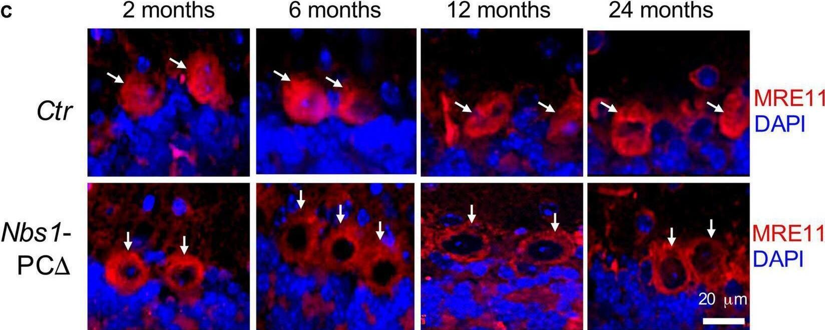 Deletion of Nbs1 is compatible with mouse survival and cerebellar development. (A) Bodyweight of 20∼24 months old mice from the indicated group. (B) Brain weight of the animal for panel (A), Error bars indicate the value mean +/- SEM; n.s., not significant. Data comparison was performed through Student’s t-test. (C,D) Deletion of Nbs1 in Purkinje cells leads to dislocation of MRE11 and RAD50. Sagittal cryo-sections of control (Ctr) and Nbs1-PC delta  mice at the indicated age were stained with anti-MRE11 (C) and anti-RAD50 (D) antibodies together with DAPI to label nuclei. The Purkinje cell layer in the cerebellum region is shown. Scale bars: 20 μm. Representative images of sections from two mice are shown. Arrows point to Purkinje cells. Image collected and cropped by CiteAb from the following open publication (//pubmed.ncbi.nlm.nih.gov/35153719), licensed under a CC-BY license. Not internally tested by Novus Biologicals.