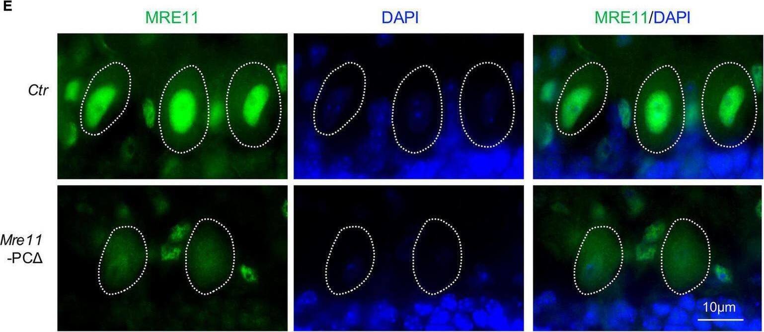 Normal brain and the cerebellum of Mre11-PC delta  mice. (A) Abdominal view of wild type (Ctr) and Mre11-PC delta  mice showed normal limbs stretching. (B) Bodyweight of control (Ctr) and Mre11-PC delta  mice at 18 months of age. The number of mice analyzed is indicated within the graph bars. Error bars indicate the value mean +/- SEM; n.s., not significant; data comparison was performed through Student’s t-test. (C) A dorsal view of the whole brain of control (Ctr) and Mre11-PC delta  mice. (D) Brain weight of 12-month-old Ctr and Mre11-PC delta  mice. The number of mice analyzed is indicated within the graph bars. Error bars indicate the value mean +/- SEM; data comparison was performed by Student’s t-test. n.s., not significant. (E) Sagittal cryosections of 18-month-old Ctr and Mre11-PC delta  mice after staining with anti-MRE11 antibody and DAPI. Note a reduction of MRE11 signal in mutant Purkinje cells. The Purkinje cell layer in the cerebellum region is shown. Dotted lines highlight the nucleus of Purkinje cells. (F,G)Mre11-PC delta  mice have normal density and morphology of Purkinje cells. Sagittal sections of control (Ctr) and Mre11-PC delta  mice were stained with Calbindin-D28K (D28K) antibody (green) and DAPI (blue) to label Purkinje cells and nuclei, respectively (F). The upper panels show the whole cerebellum, and the lower panels show the magnified view of red frames in the respective upper panels. ML, molecular layer; PCL, Purkinje cell layer. (G) Quantification of total Purkinje cell number in each individual cerebellar lobule from panel (F). Three mice of each genotype were analyzed. Error bars indicate the value mean +/- SEM; data comparison was performed through Student’s t-test. n.s., not significant. Image collected and cropped by CiteAb from the following open publication (//pubmed.ncbi.nlm.nih.gov/35153719), licensed under a CC-BY license. Not internally tested by Novus Biologicals.