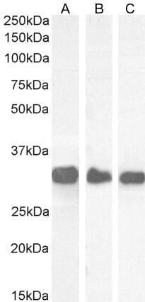 Western Blot: FHL1 Antibody [NB100-1460] - (0.1ug/ml) staining of Mouse Skeletal Muscle (A), Rat Lung (B) and Rat Skeletal Muscle (C) lysate (35ug protein in RIPA buffer). Detected by chemiluminescence.