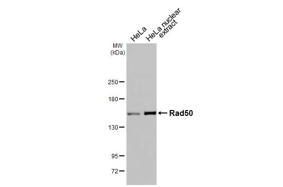 HeLa whole cell and nuclear extracts (30 ug) were separated by 5% SDS-PAGE, and the membrane was blotted with Rad50 antibody [13B3] (NB100-147) diluted at 1:1000. The HRP-conjugated anti-mouse IgG antibody was used to detect the primary antibody. 
